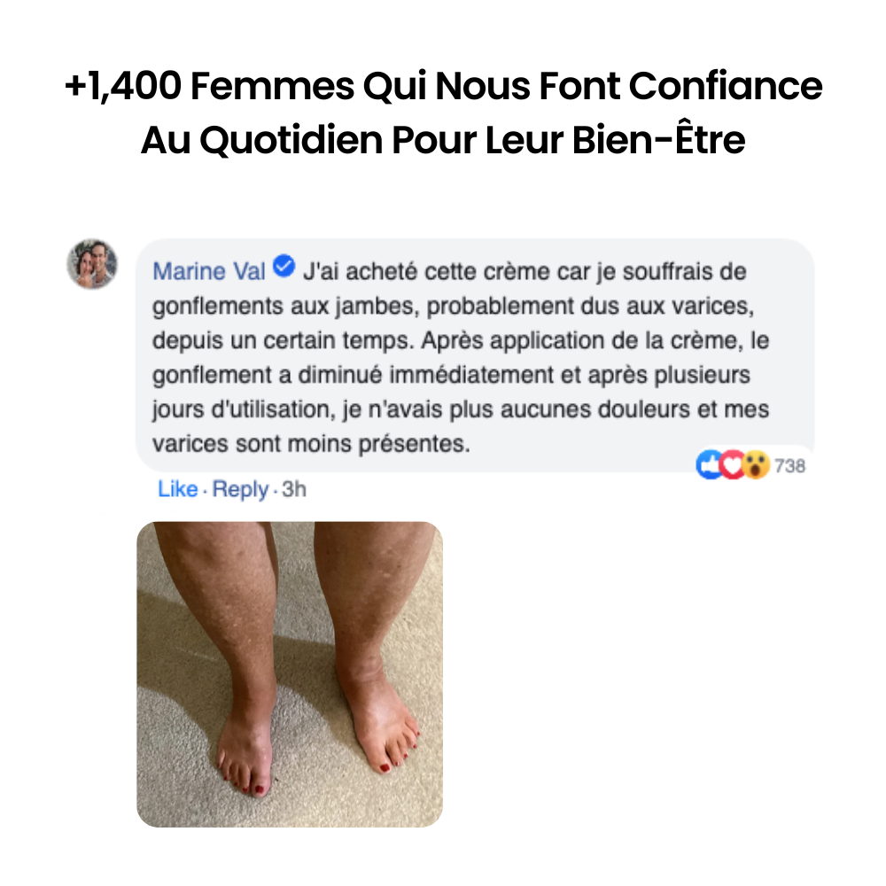 Nervalis – Crème Apaisante Pour Jambes Gonflées ( Lot de 80 )