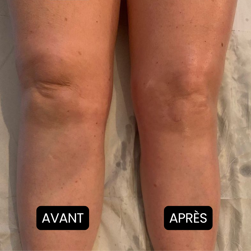 Nervalis – Crème Apaisante Pour Jambes Gonflées ( Lot de 80 )