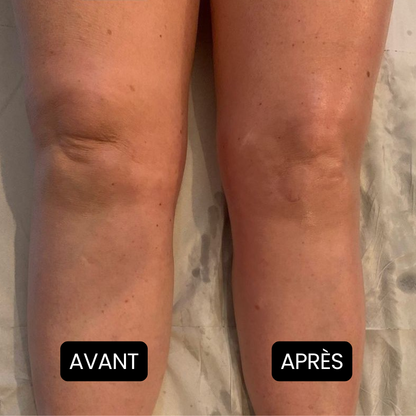 Nervalis – Crème Apaisante Pour Jambes Gonflées ( Lot de 80 )