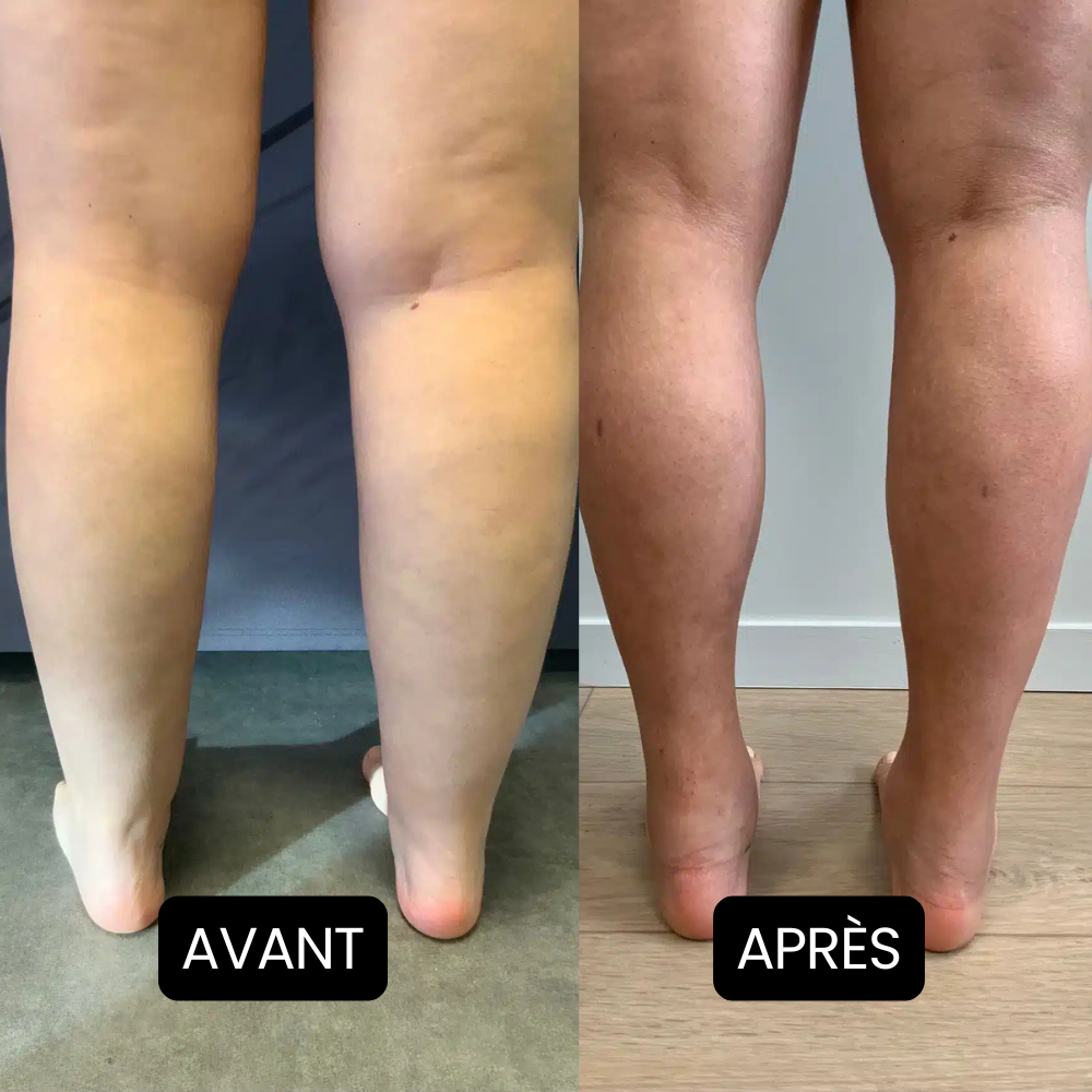 Nervalis – Crème Apaisante Pour Jambes Gonflées ( Lot de 80 )