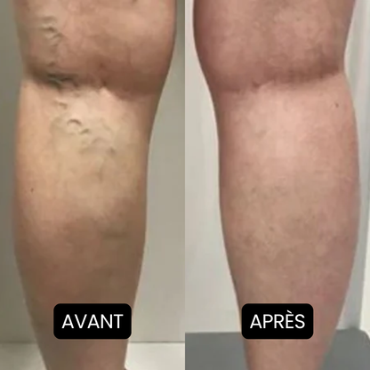 Nervalis – Crème Apaisante Pour Jambes Gonflées ( Lot de 80 )